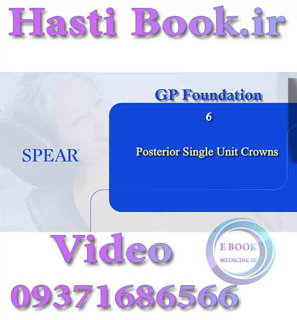 فیلم video  SPEAR GP Foundation 6, Posterior Single Unit Crowns