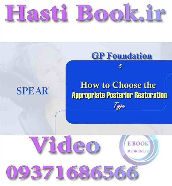 فیلم video SPEAR GP Foundation 5, How to Choose the Appropriate Posterior Restoration Type