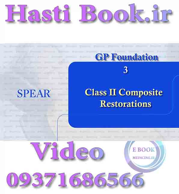 فیلم SPEAR GP Foundation 3, Class II Composite Restorations