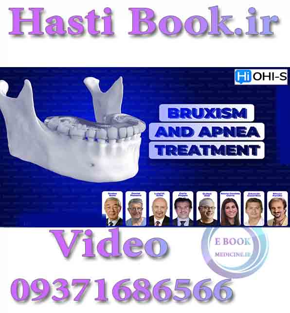 فیلم  OHI-S Bruxism and Sleep Apnea Treatment