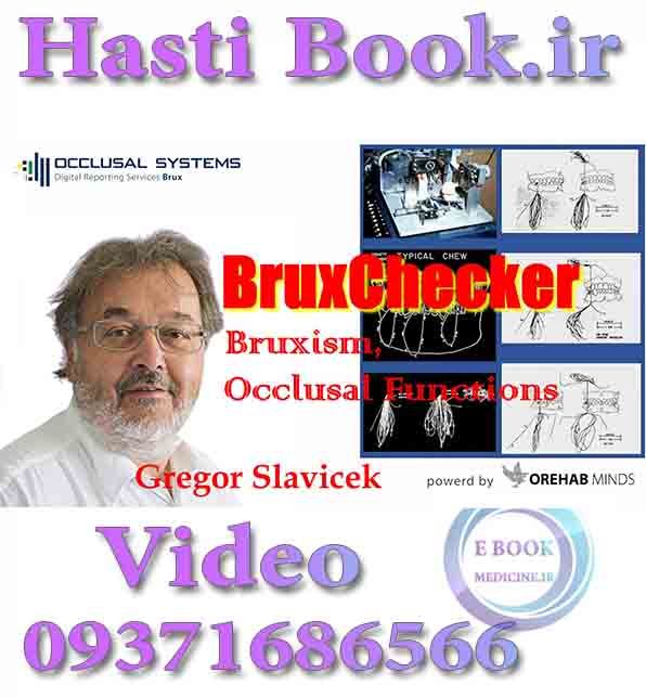 فیلم OCLUSYS BruxChecker, Bruxism, Occlusal Functions - Gregor Slavicek