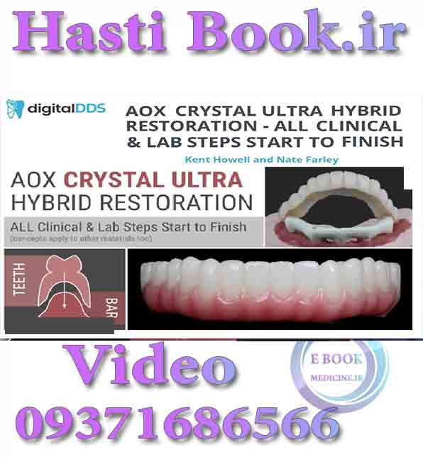 فیلم DigitalDDS AOX Crystal Ultra Hybrid Restoration - All Clinical & Lab Steps Start to Finish, Kent Howell, Nate Farley