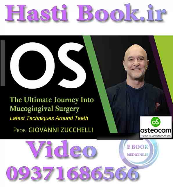 فیلم Osteocom The Ultimate Journey into Mucogingival Surgery, Latest Techniques Around Teeth - Giovanni Zucchelli