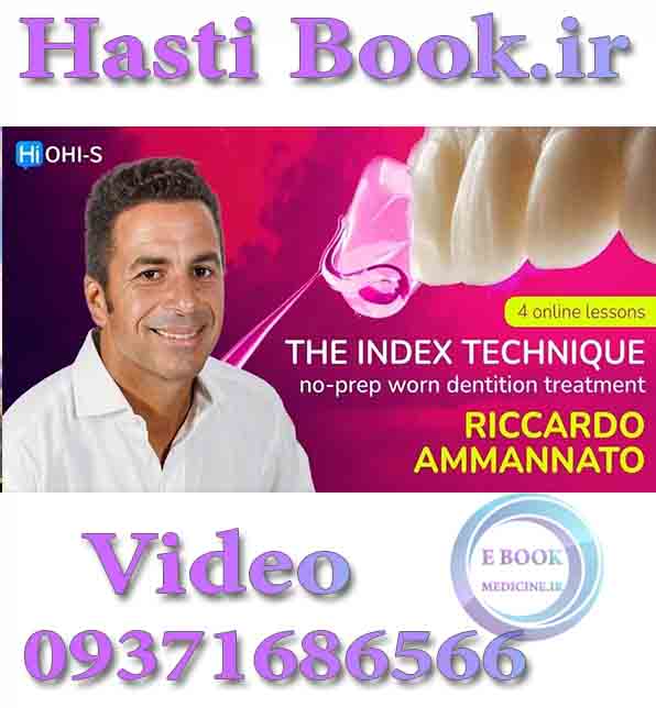 فیلم OHI-S The INDEX Technique, No Prep Worn Dentition Treatment - Ricardo Ammannato