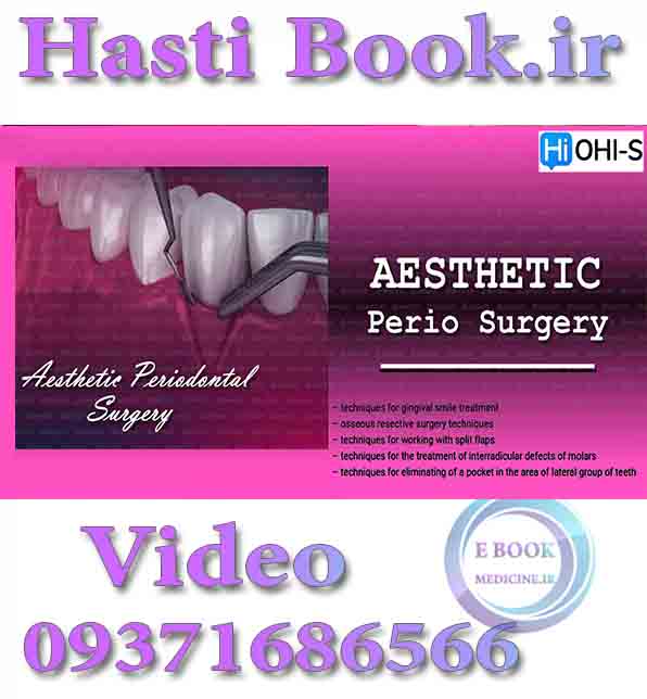 فیلم OHI-S Aesthetic Periodontal Surgery