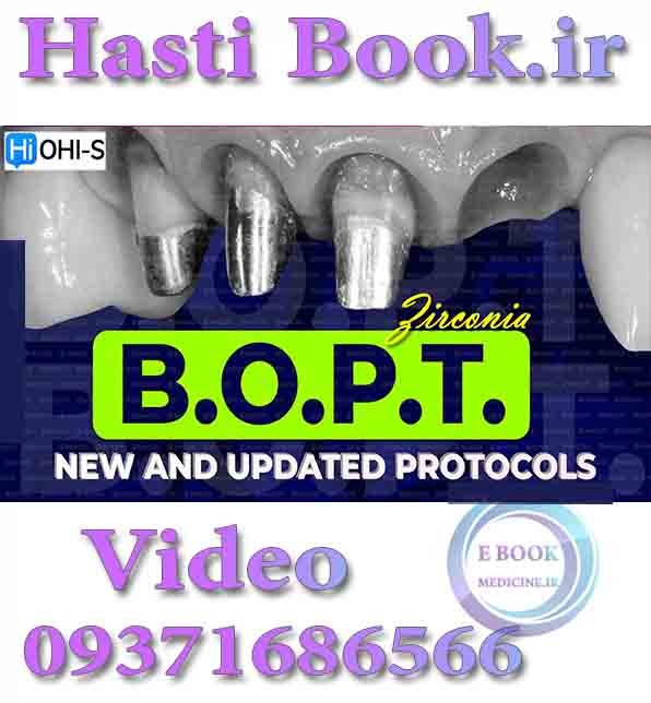 فیلم  OHI-S Zirconia BOPT, New and Updated Protocols
