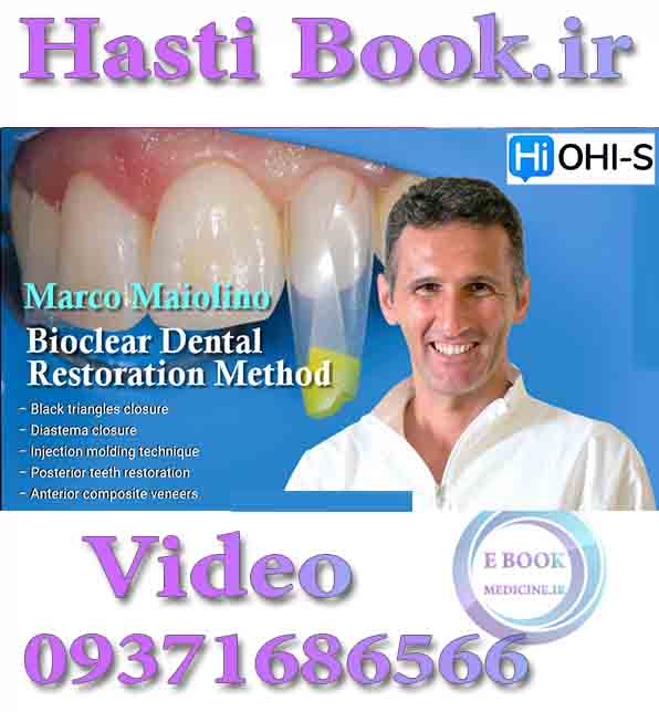 فیلم  OHI-S Bioclear Dental Restoration Method - Marco Maiolino