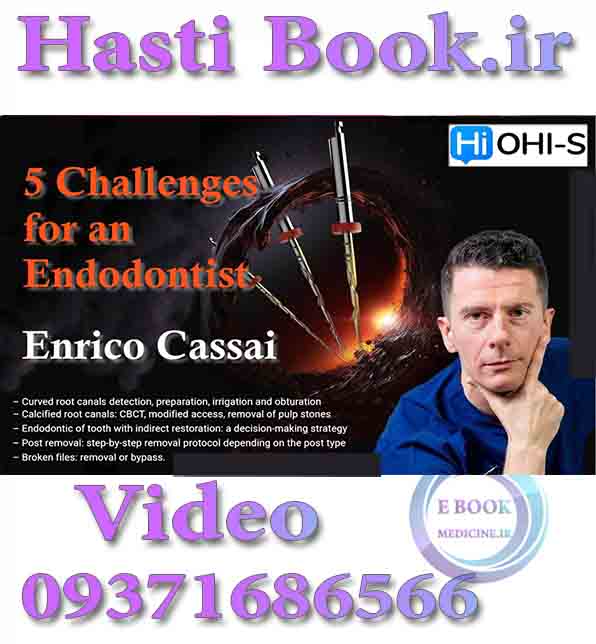 فیلم OHI-S 5 Challenges for an Endodontist - Enrico Cassai