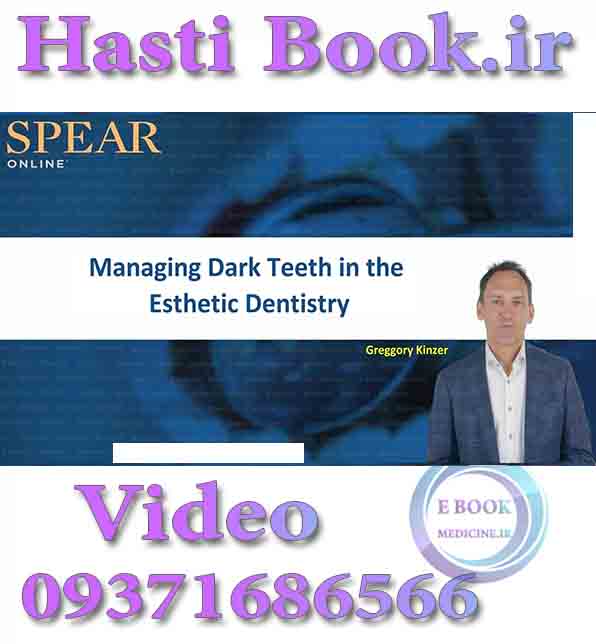 فیلم Spear Managing Dark Teeth in the Esthetic Dentistry - Greggory Kinzer video