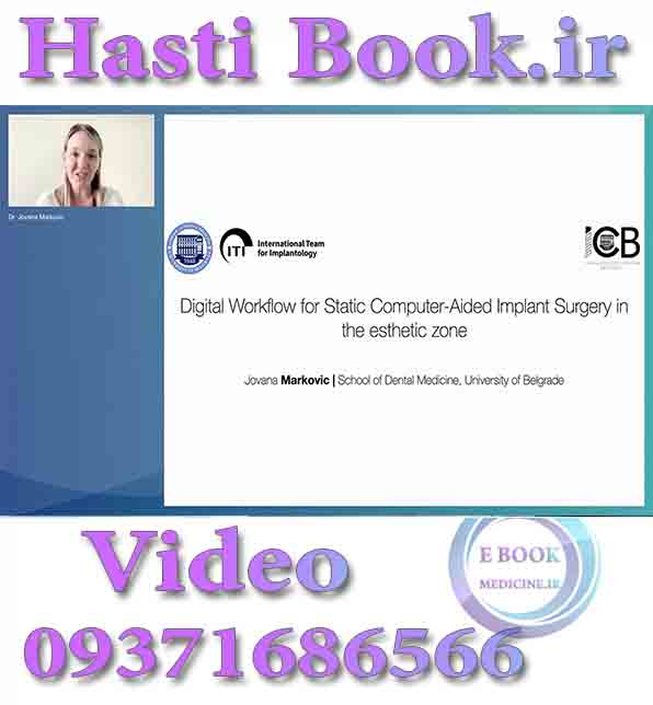 فیلم ITI Digital Workflow for Static Computer-Aided Implant Surgery in the Esthetic Zone - Jovana Markovic video