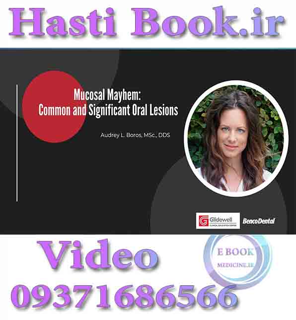 فیلم Glidewell Mucosal Mayhem, Common and Significant Oral Lesions - Audrey L. Boros video
