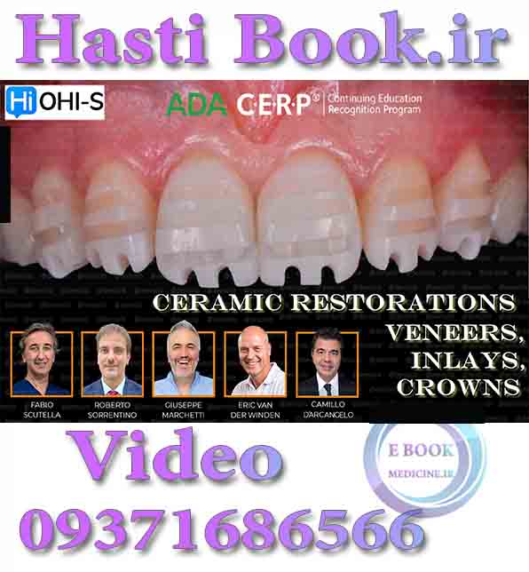 فیلم OHI-S Ceramic Restorations Veneers, Inlays, Crowns video