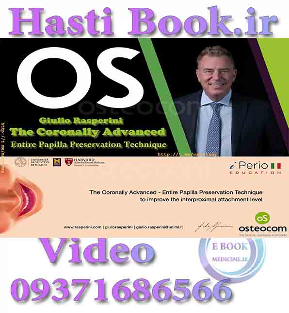 فیلم Osteocom The Coronally Advanced Entire Papilla Preservation Technique - Giulio Rasperini video