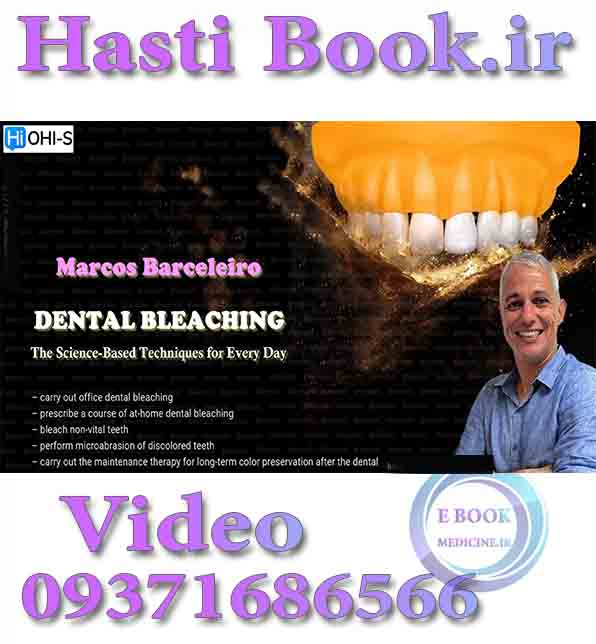 فیلم OHI-S Dental Bleaching - Marcos Barceleiro The Science Based Techniques for Every Day